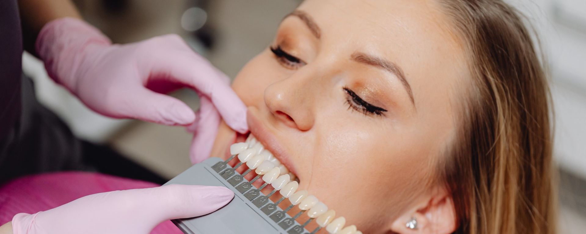 Teeth Whitening in Whiteley | Save £200 on Boutique Whitening
