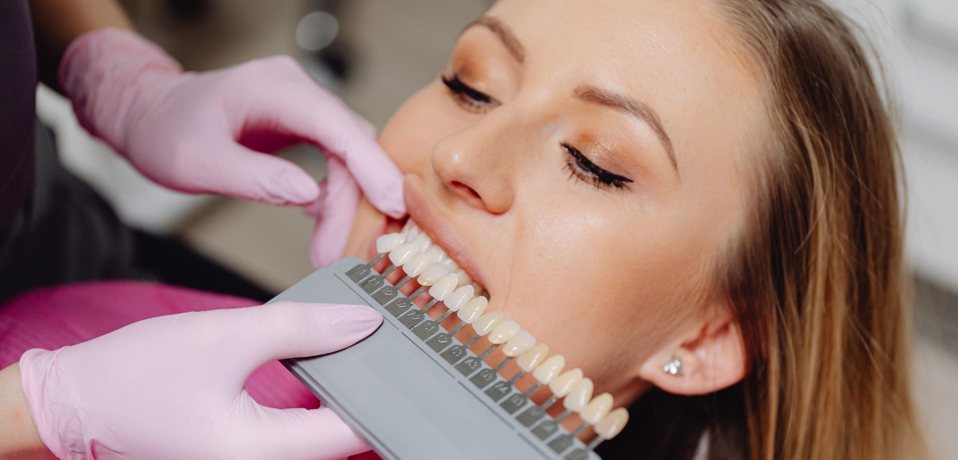 Teeth Whitening in Whiteley | Save £200 on Boutique Whitening