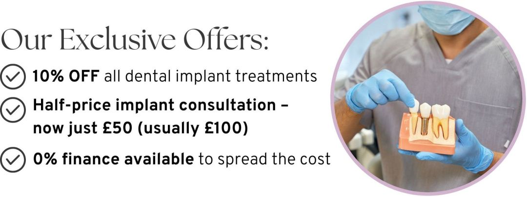 Dental Implant Event | May & June 2026 